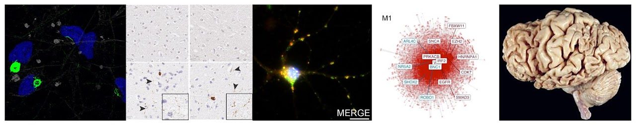 Panels from lab work: fluorescent neuronal culture, tissue pathology, a labelled neuron, a gene co-expression network, and a human brain.